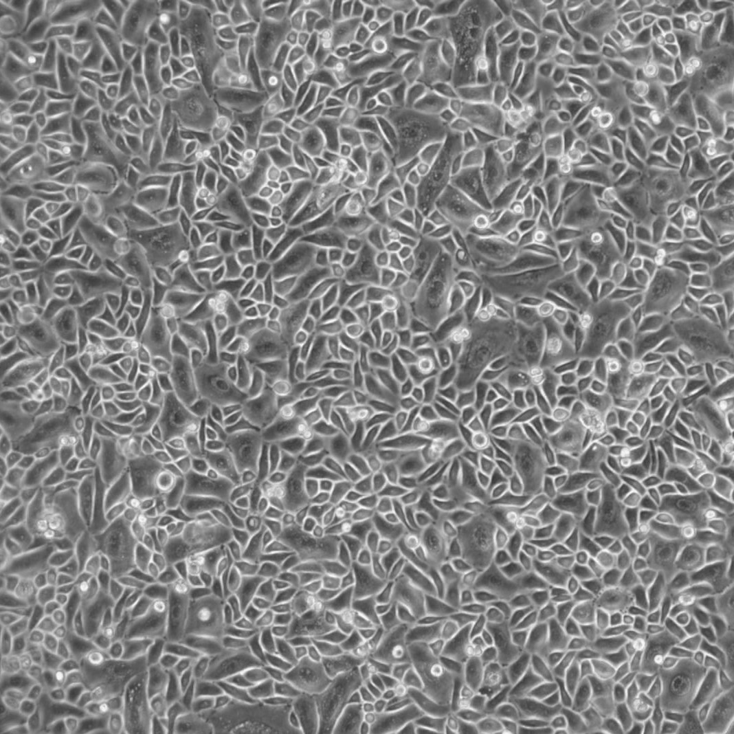 人小气道病变上皮细胞-原代 FC-0067 Diseased Small Airway Epithelial Cells, Primary
